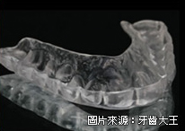 全瓷冠是什麼、全瓷冠推薦、全瓷牙冠